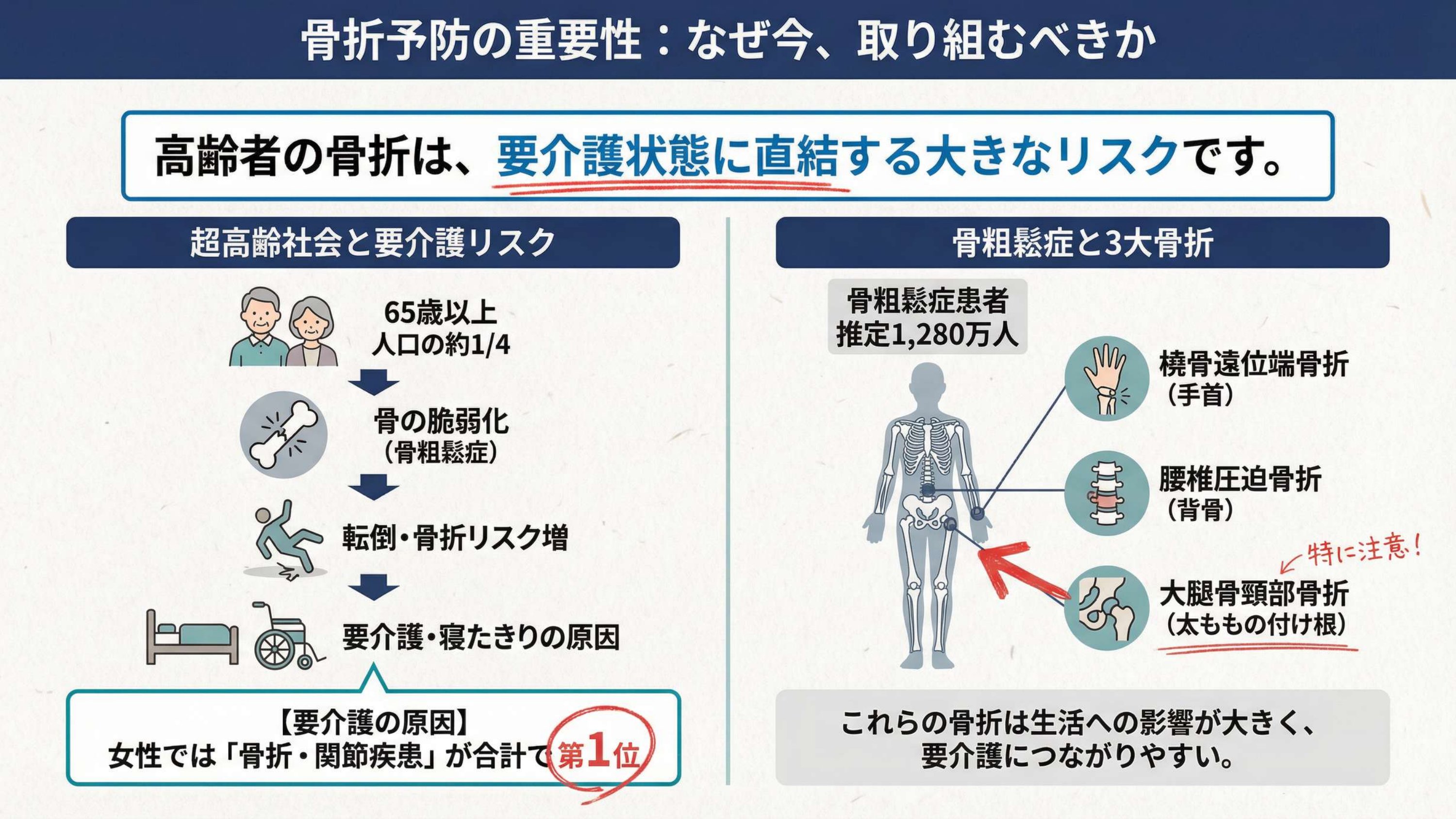 なぜ今“骨折予防”か——3大骨折と要介護リスク
