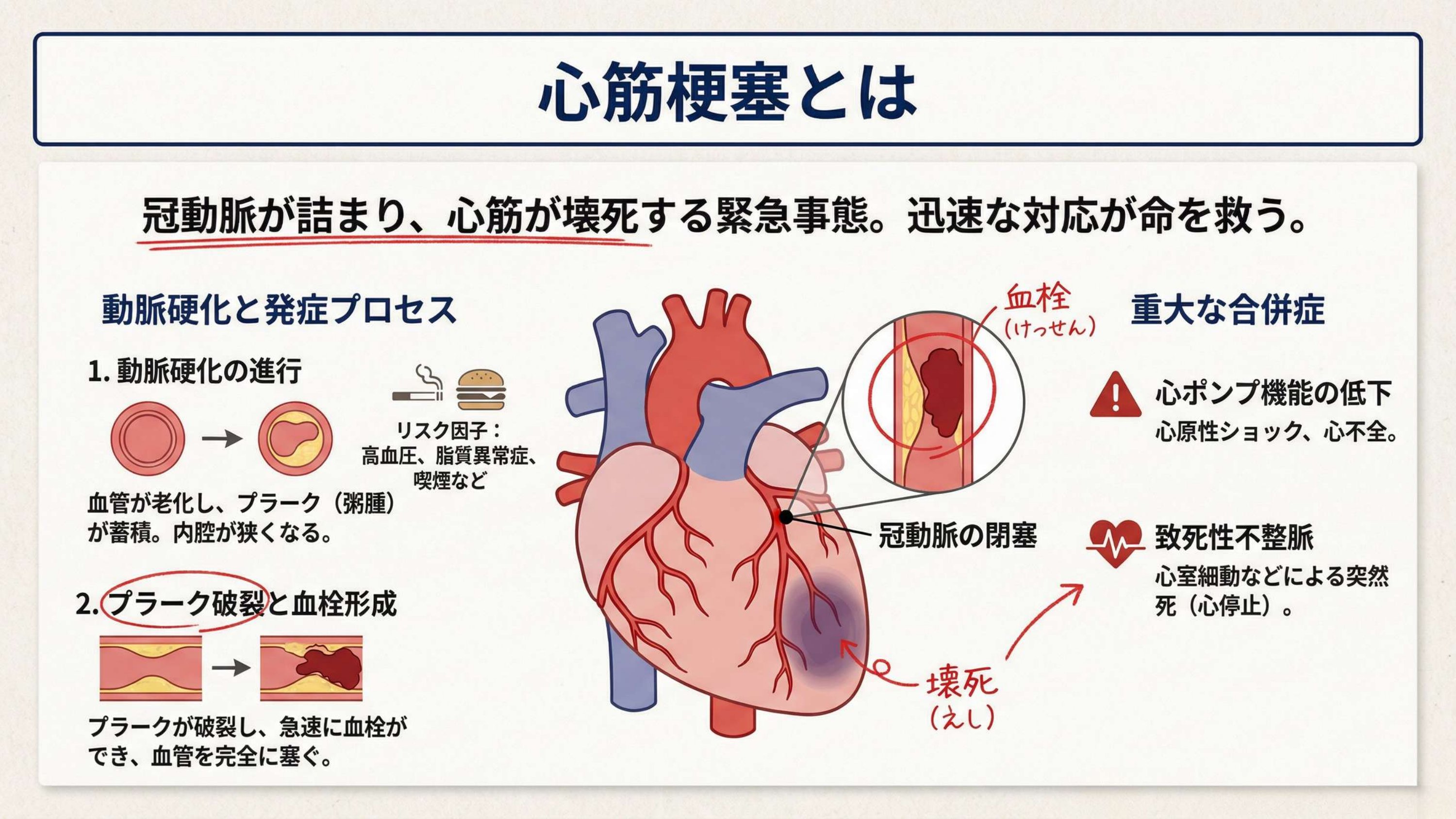 なぜ起こる？——動脈硬化からのメカニズム